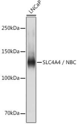 Western Blot: SLC4A4 Antibody [NBP2-94138] - Western blot analysis of extracts of LNCaP cells, using SLC4A4 antibody (NBP2-94138) at 1:1000 dilution. Secondary antibody: HRP Goat Anti-Rabbit IgG (H+L) at 1:10000 dilution. Lysates/proteins: 25ug per lane. Blocking buffer: 3% nonfat dry milk in TBST. Detection: ECL Basic Kit. Exposure time: 1s.