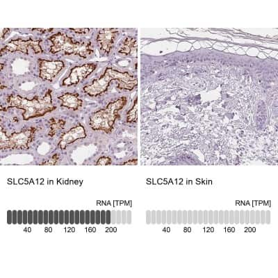 Immunohistochemistry-Paraffin SLC5A12 Antibody