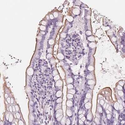 Immunohistochemistry-Paraffin SLC5A12 Antibody