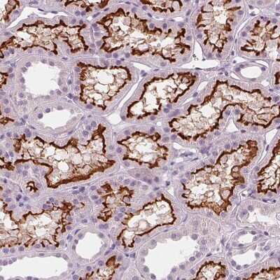 Immunohistochemistry-Paraffin SLC5A12 Antibody