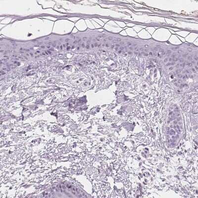 Immunohistochemistry-Paraffin: SLC5A12 Antibody [NBP2-49322] - Staining of human skin shows no positivity in keratinocytes as expected.