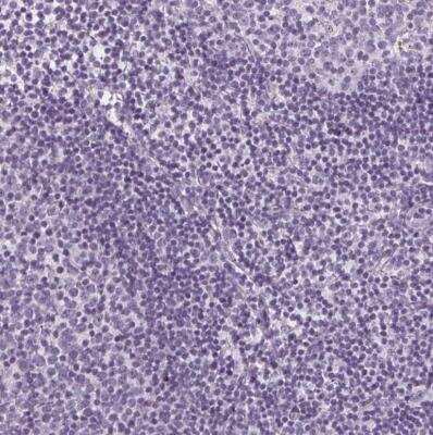 Immunohistochemistry-Paraffin: SLC5A12 Antibody [NBP2-49322] - Staining of human lymph node shows no positivity in non-germinal center cells as expected.