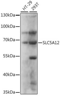 Western Blot: SLC5A12 Antibody [NBP2-93974] - Analysis of extracts of various cell lines, using SLC5A12 at 1:1000 dilution. Secondary antibody: HRP Goat Anti-Rabbit IgG (H+L) at 1:10000 dilution. Lysates/proteins: 25ug per lane. Blocking buffer: 3% nonfat dry milk in TBST. Detection: ECL Basic Kit . Exposure time: 5s.