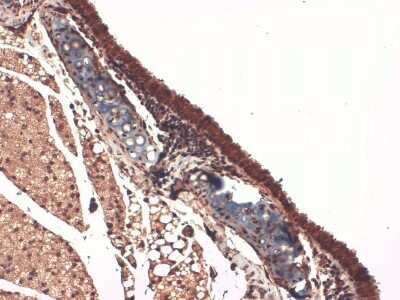 Immunohistochemistry: SLC5A5/Sodium Iodide Symporter Antibody (14F) [NBP2-59341] - Immunohistochemistry analysis using Mouse Anti-SLC5A5/Sodium Iodide Symporter Monoclonal Antibody, Clone 14F (NBP2-59341). Tissue: Trachea. Species: Mouse. Fixation: 10% Formalin Solution for 12-24 hours at RT. Primary Antibody: Mouse Anti-SLC5A5/Sodium Iodide Symporter Monoclonal Antibody (NBP2-59341) at 1:1000 for 1 hour at RT. Secondary Antibody: HRP/DAB Detection System: Biotinylated Goat Anti-Mouse, Streptavidin Peroxidase, DAB Chromogen (brown) for 30 minutes at RT. Counterstain: Mayer Hematoxylin (purple/blue) nuclear stain at 250-500 l for 5 minutes at RT.