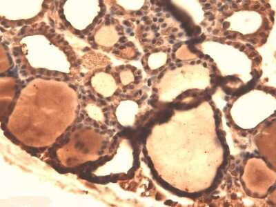 Immunohistochemistry: SLC5A5/Sodium Iodide Symporter Antibody (14F) [NBP2-59341] - Immunohistochemistry analysis using Mouse Anti-SLC5A5/Sodium Iodide Symporter Monoclonal Antibody, Clone 14F (NBP2-59341). Tissue: Thyroid. Species: Mouse. Fixation: 10% Formalin Solution for 12-24 hours at RT. Primary Antibody: Mouse Anti-SLC5A5/Sodium Iodide Symporter Monoclonal Antibody (NBP2-59341) at 1:1000 for 1 hour at RT. Secondary Antibody: HRP/DAB Detection System: Biotinylated Goat Anti-Mouse, Streptavidin Peroxidase, DAB Chromogen (brown) for 30 minutes at RT. Counterstain: Mayer Hematoxylin (purple/blue) nuclear stain at 250-500 l for 5 minutes at RT.