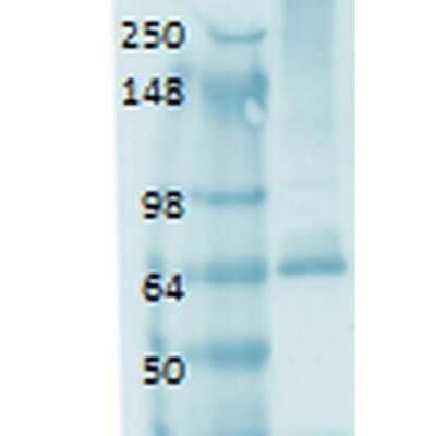 Western Blot: SLC5A5/Sodium Iodide Symporter Antibody (14F) [NBP2-59341] - Western Blot analysis of Human thyroid lysate showing detection of SLC5A5/Sodium Iodide Symporter protein using Mouse Anti-SLC5A5/Sodium Iodide Symporter Monoclonal Antibody, Clone 14F (NBP2-59341). Primary Antibody: Mouse Anti-SLC5A5/Sodium Iodide Symporter Monoclonal Antibody (NBP2-59341) at 1:1000.