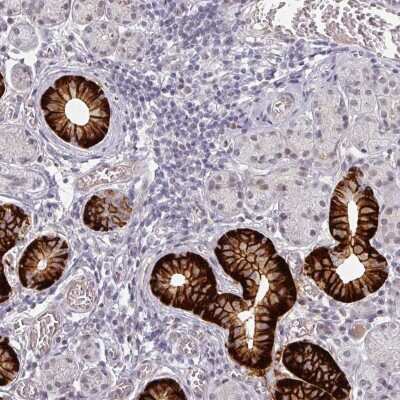 Immunohistochemistry-Paraffin: SLC5A5/Sodium Iodide Symporter Antibody [NBP2-33547] - Staining of human salivary gland shows membranous positivity in ductal cells.