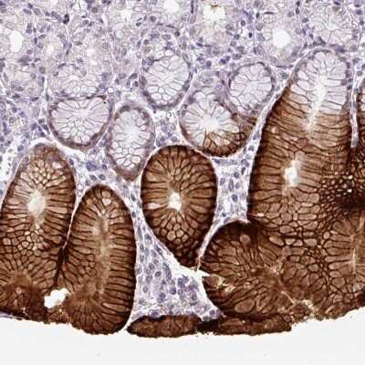 Immunohistochemistry-Paraffin: SLC5A5/Sodium Iodide Symporter Antibody [NBP2-33547] - Staining of human stomach shows strong cytoplasmic positivity in glandular cells.