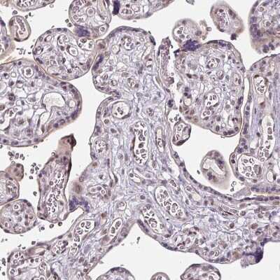 Immunohistochemistry-Paraffin: SLC5A5/Sodium Iodide Symporter Antibody [NBP2-33547] - Staining of human placenta shows no positivity in trophoblastic cells.