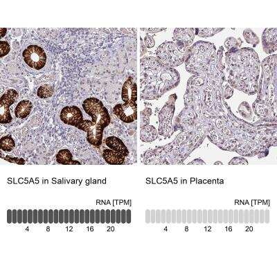 Immunohistochemistry-Paraffin: SLC5A5/Sodium Iodide Symporter Antibody [NBP2-33547] - Analysis in human salivary gland and placenta tissues using HPA049055 antibody. Corresponding SLC5A5 RNA-seq data are presented for the same tissues.