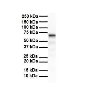 Western Blot: SLC5A5/Sodium Iodide Symporter Antibody [NBP1-59851] - Antibody  Titration: 1 ug/ml Human liver.