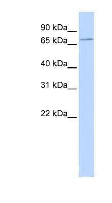 Western Blot: SLC5A5/Sodium Iodide Symporter Antibody [NBP1-62517] - Titration: 0.2-1 ug/ml, Positive Control: 293T cell lysate.