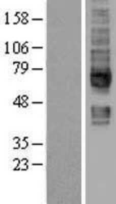 Western Blot: SLC5A6 Overexpression Lysate (Adult Normal) [NBL1-16175] Left-Empty vector transfected control cell lysate (HEK293 cell lysate); Right -Over-expression Lysate for SLC5A6.