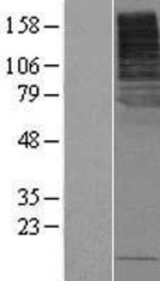 Western Blot SLC5A8/SMCT1 Overexpression Lysate