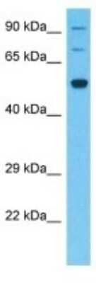 Western Blot: SLC5A8/SMCT1 Antibody [NBP3-10577] - Western blot analysis of SLC5A8/SMCT1 in Fetal Kidney lysates. Antibody dilution at 1.0ug/ml