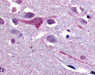 Immunohistochemistry: SLC5A9 Antibody [NBP2-47136] - Analysis of  human brain cortex tissue.