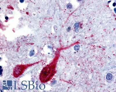 Immunohistochemistry-Paraffin: SLC5A9 Antibody [NBP2-47141] - Anti-SLC5A9 antibody IHC of human brain, cortex. Immunohistochemistry of formalin-fixed, paraffin-embedded tissue after heat-induced antigen retrieval.