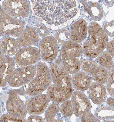 Immunohistochemistry-Paraffin: SLC6A12 Antibody [NBP1-88641] - Staining of human kidney shows moderate cytoplasmic and luminal membranous positivity in cells in tubules.