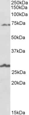 Western Blot: SLC6A12 Antibody [NBP2-26172] - Staining of Human Olfactory bulb lysate (35 ug protein in RIPA buffer). Primary incubation was 1 hour. Detected by chemiluminescence.  