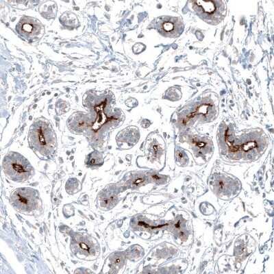 Immunohistochemistry-Paraffin SLC6A14 Antibody