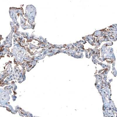 Immunohistochemistry-Paraffin SLC6A14 Antibody