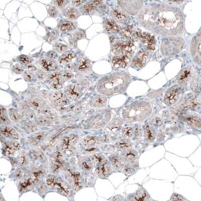 Immunohistochemistry-Paraffin SLC6A14 Antibody