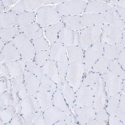 Immunohistochemistry-Paraffin: SLC6A14 Antibody [NBP1-86521] - Staining of human skeletal muscle shows no positivity in myocytes as expected.