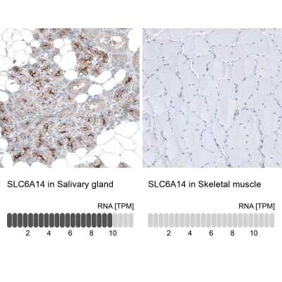 Immunohistochemistry-Paraffin: SLC6A14 Antibody [NBP1-86521] - Staining in human salivary gland and skeletal muscle tissues using NBP1-86521 antibody. Corresponding SLC6A14 RNA-seq data are presented for the same tissues.