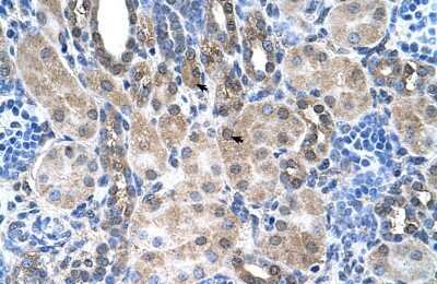 Immunohistochemistry-Paraffin: SLC6A18 Antibody [NBP1-59903] - Human kidney Tissue, antibody concentration 4-8ug/ml. Cells with positive label: renal corpuscle cells (indicated with arrows) 400X magnification.