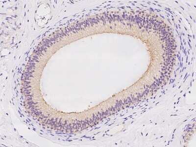 Immunohistochemistry-Paraffin SLC6A18 Antibody