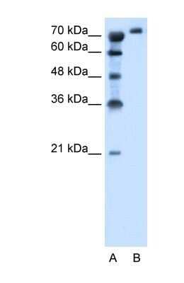 Western Blot SLC6A18 Antibody