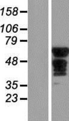 Western Blot SLC6A18 Overexpression Lysate