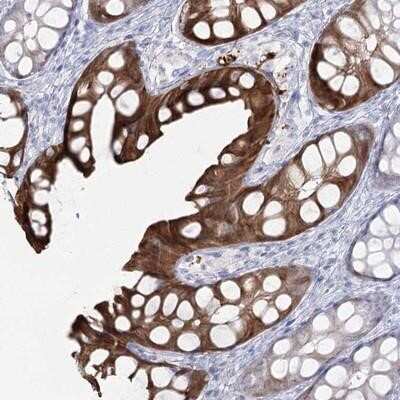 Immunohistochemistry-Paraffin: SLC6A19 Antibody [NBP1-86277] - Staining of human colon shows strong cytoplasmic positivity in glandular cells.