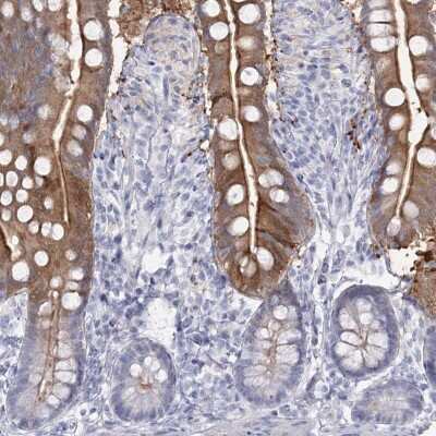 Immunohistochemistry-Paraffin SLC6A19 Antibody