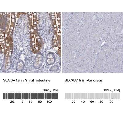 <b>Orthogonal Strategies Validation. </b>Immunohistochemistry-Paraffin: SLC6A19 Antibody [NBP1-86277] - Staining in human small intestine and pancreas tissues using anti-SLC6A19 antibody. Corresponding SLC6A19 RNA-seq data are presented for the same tissues.