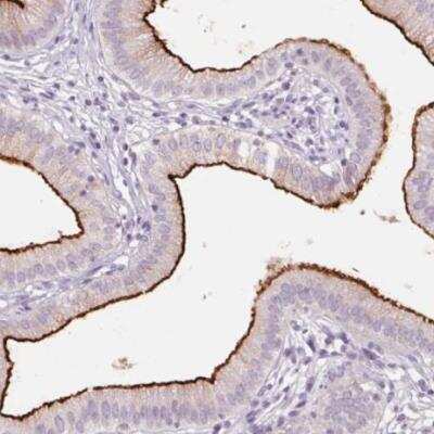 Immunohistochemistry-Paraffin: SLC6A19 Antibody [NBP2-48784] - Staining of human gallbladder shows strong positivity in apical membrane in glandular cells. 