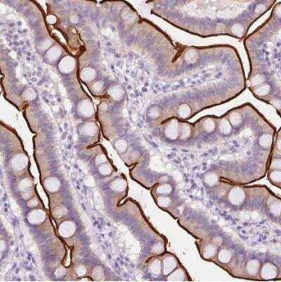 Immunohistochemistry-Paraffin: SLC6A19 Antibody [NBP2-48784] - Staining of human duodenum shows strong positivity  in apical membrane in glandular cells.