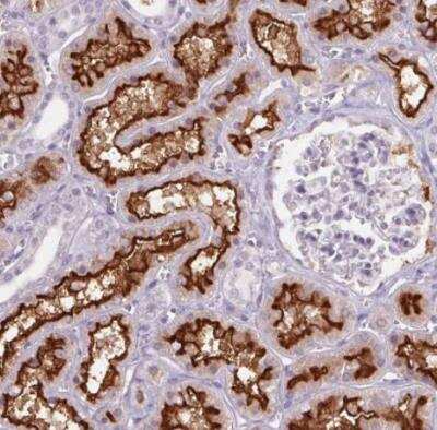 Immunohistochemistry-Paraffin: SLC6A19 Antibody [NBP2-48784] - Staining of human kidney shows strong membranous positivity in cells in tubules.