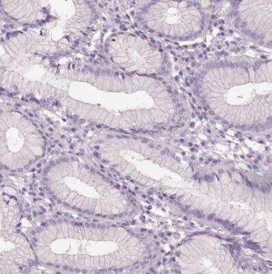 Immunohistochemistry-Paraffin: SLC6A19 Antibody [NBP2-48784] - Staining of human stomach shows no membranous positivity in glandular cells as expected.