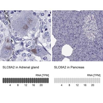 Immunohistochemistry-Paraffin: SLC6A2/NET/Noradrenaline transporter Antibody [NBP2-62704] - Analysis in human adrenal gland and pancreas tissues using Anti-SLC6A2 antibody. Corresponding SLC6A2 RNA-seq data are presented for the same tissues.