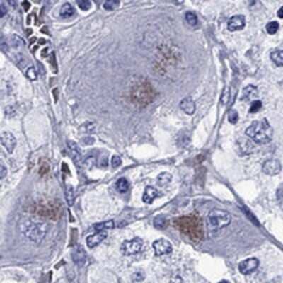 <b>Orthogonal Strategies Validation. </b>Immunohistochemistry-Paraffin: SLC6A2/NET/Noradrenaline transporter Antibody [NBP2-62704] - Staining of human adrenal gland shows high expression.