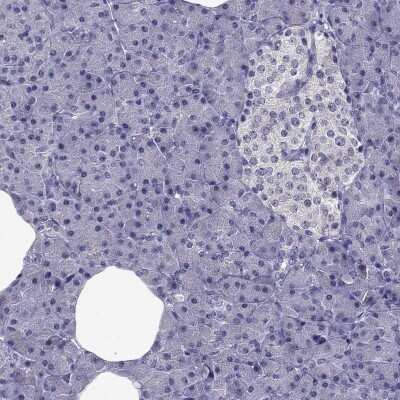 Immunohistochemistry-Paraffin: SLC6A2/NET/Noradrenaline transporter Antibody [NBP2-62704] - Staining of human pancreas shows low expression as expected.