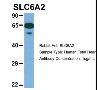 Western Blot: SLC6A2/NET/Noradrenaline transporter Antibody [NBP1-60120] - Human Fetal Heart.