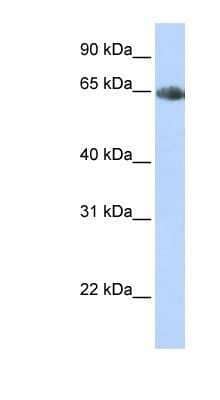 Western Blot: SLC6A2/NET/Noradrenaline transporter Antibody [NBP1-60120] - Titration: 0.2-1 ug/ml, Positive Control: Human heart.