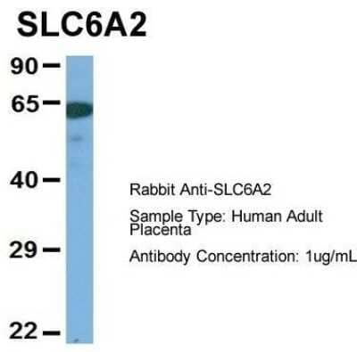 Western Blot: SLC6A2/NET/Noradrenaline transporter Antibody [NBP1-60120] - Human Adult Placenta