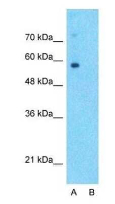 Western Blot: SLC6A2/NET/Noradrenaline transporter Antibody [NBP1-60120] - Tissue:Human Fetal Lung.