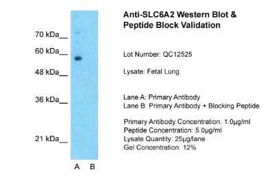 Western Blot: SLC6A2/NET/Noradrenaline transporter Antibody [NBP1-60120] - Sample Tissue: Human Fetal Lung, Lane A: Primary Antibody, Lane B: Primary Antibody + Blocking Peptide, Primary Antibody Concentration: 1ug/ml, Peptide Concentration: 5ug/ml, Lysate Quantity: 25ug/lane/lane, Gel Concentration: 0.12