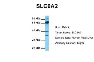 Western Blot: SLC6A2/NET/Noradrenaline transporter Antibody [NBP1-60120] - Sample Tissue: Human Fetal Liver Antibody Dilution: 1.0 ug/ml