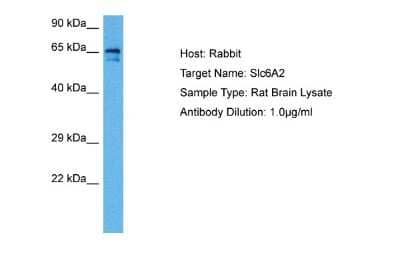 Western Blot: SLC6A2/NET/Noradrenaline transporter Antibody [NBP2-85762] - Host: Rabbit. Target Name: SLC6A2. Sample Tissue: Rat Brain. Antibody Dilution: 1ug/ml