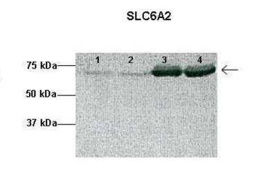 Western Blot: SLC6A2/NET/Noradrenaline transporter Antibody [NBP2-85762] - Researcher: Lesie Sheiton, Physiological Sciences GIDP, University of Arizona. Application: Western blotting. Species + Tissue/Cell type: 1: 50ug human placenta lysate, 2: 50ug human placenta lysate, 3: 50ug sheep placenta lysate, 4: 50ug sheep placenta lysate. Primary antibody dilution: 1:1000. Secondary antibody: Anti-rabbit HRP. Secondary antibody dilution: 1:20,000